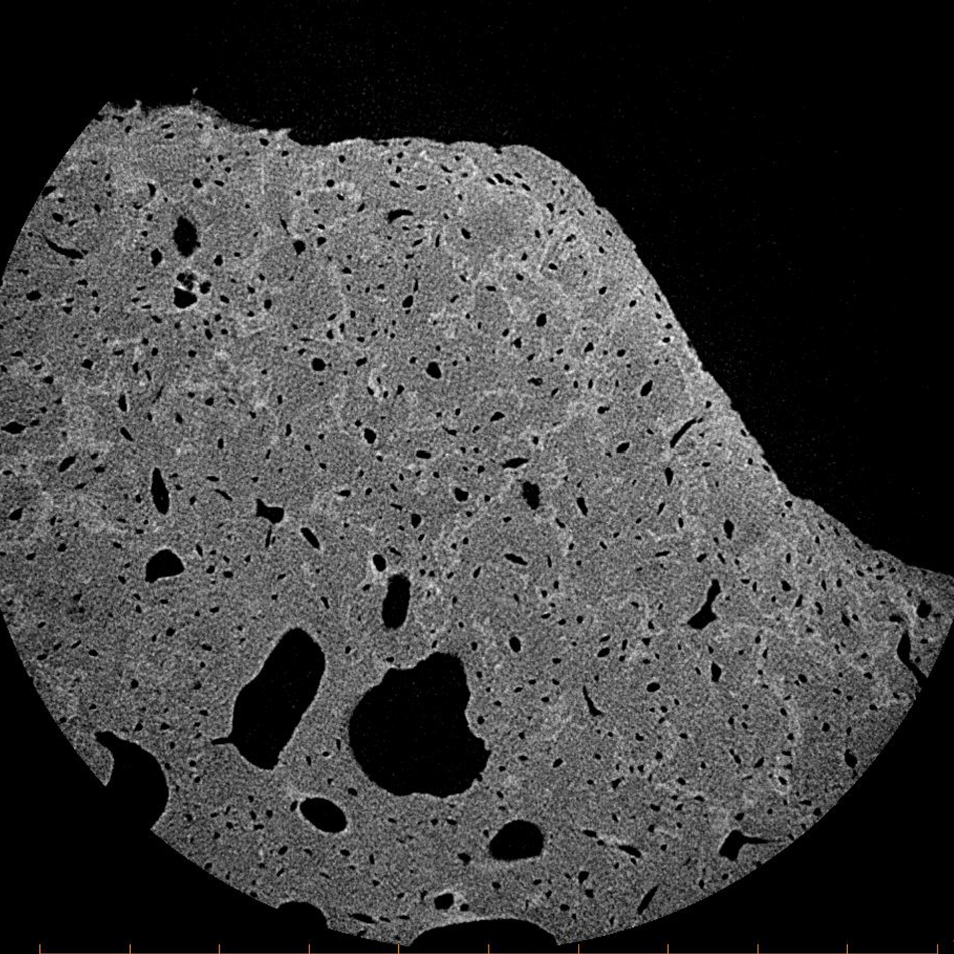 MicroCT image of bone lacunae