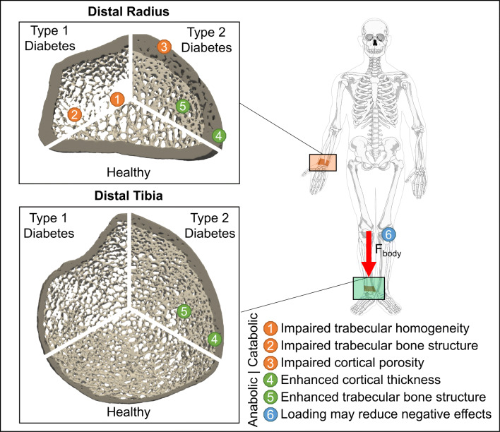Meta-analysis of Diabetes Mellitus-Associated Differences in Bone Structure Assessed by High-Resolution Peripheral Quantitative Computed Tomography.