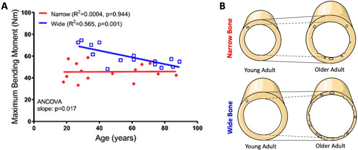 Characterizing Bone Phenotypes Related to Skeletal Fragility Using Advanced Medical Imaging.