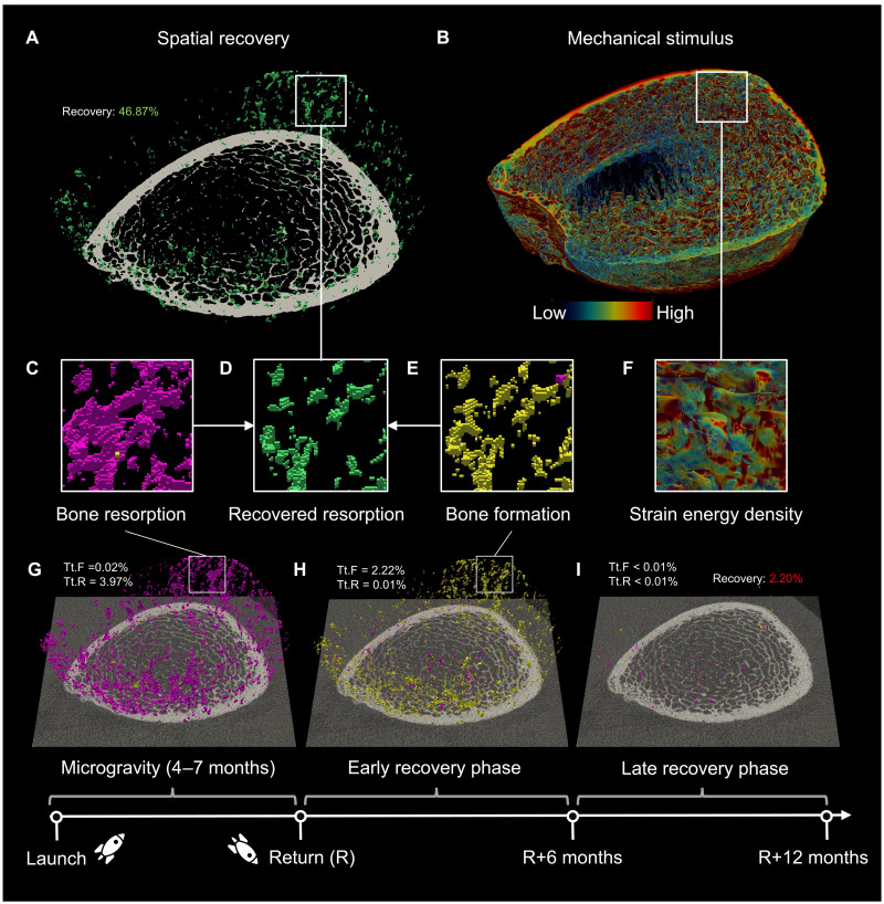 Tracking of spaceflight-induced bone remodeling reveals a limited time frame for recovery of resorption sites in humans.