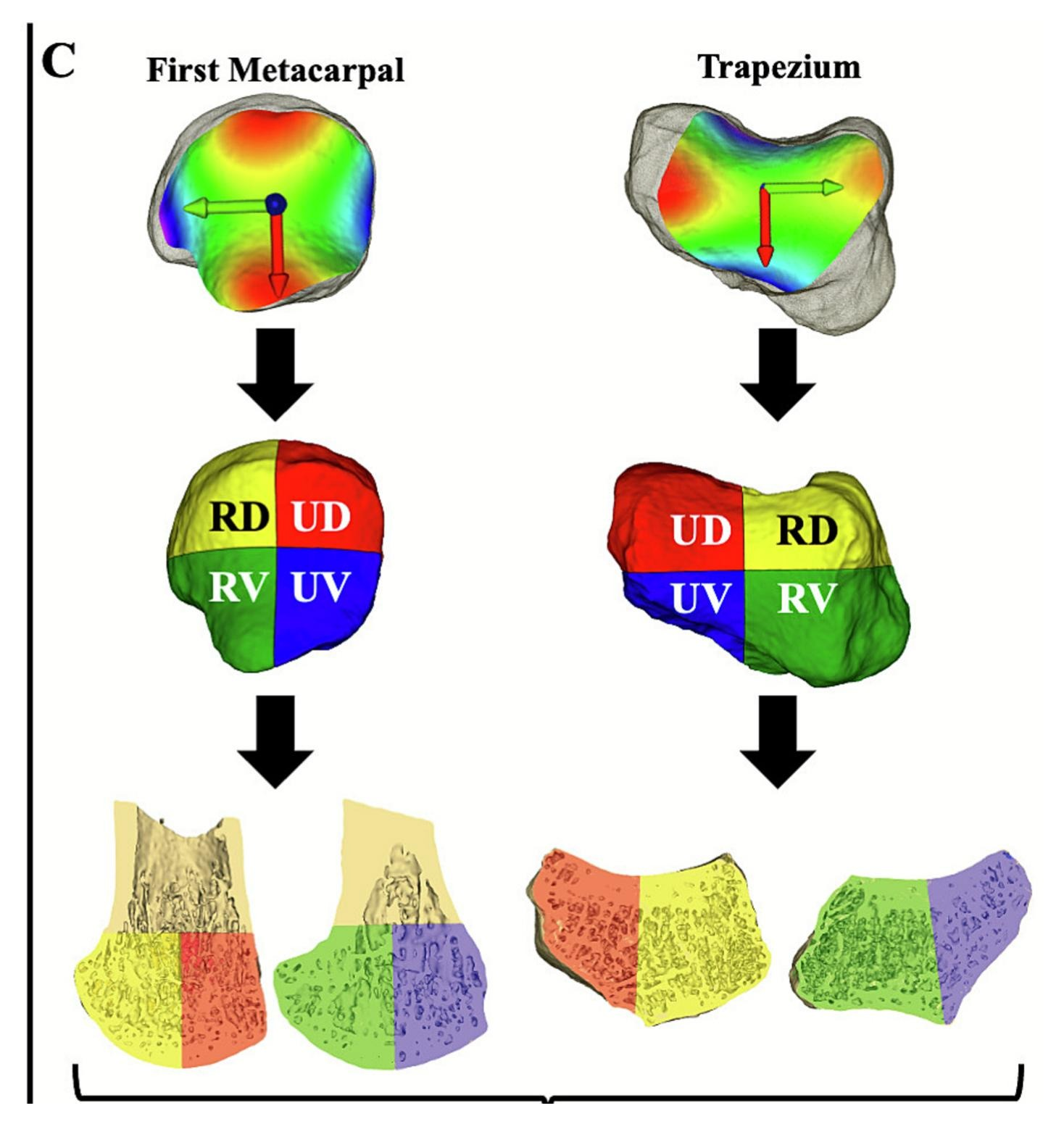 Region-specific variation in trapeziometacarpal joint bone microarchitecture in females with osteoarthritis assessed using HR-pQCT.