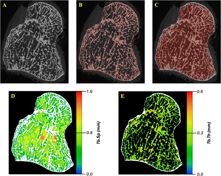 Improved segmentation accuracy in high-resolution peripheral quantitative computed tomography scans of carpal bones using adaptive local thresholding.
